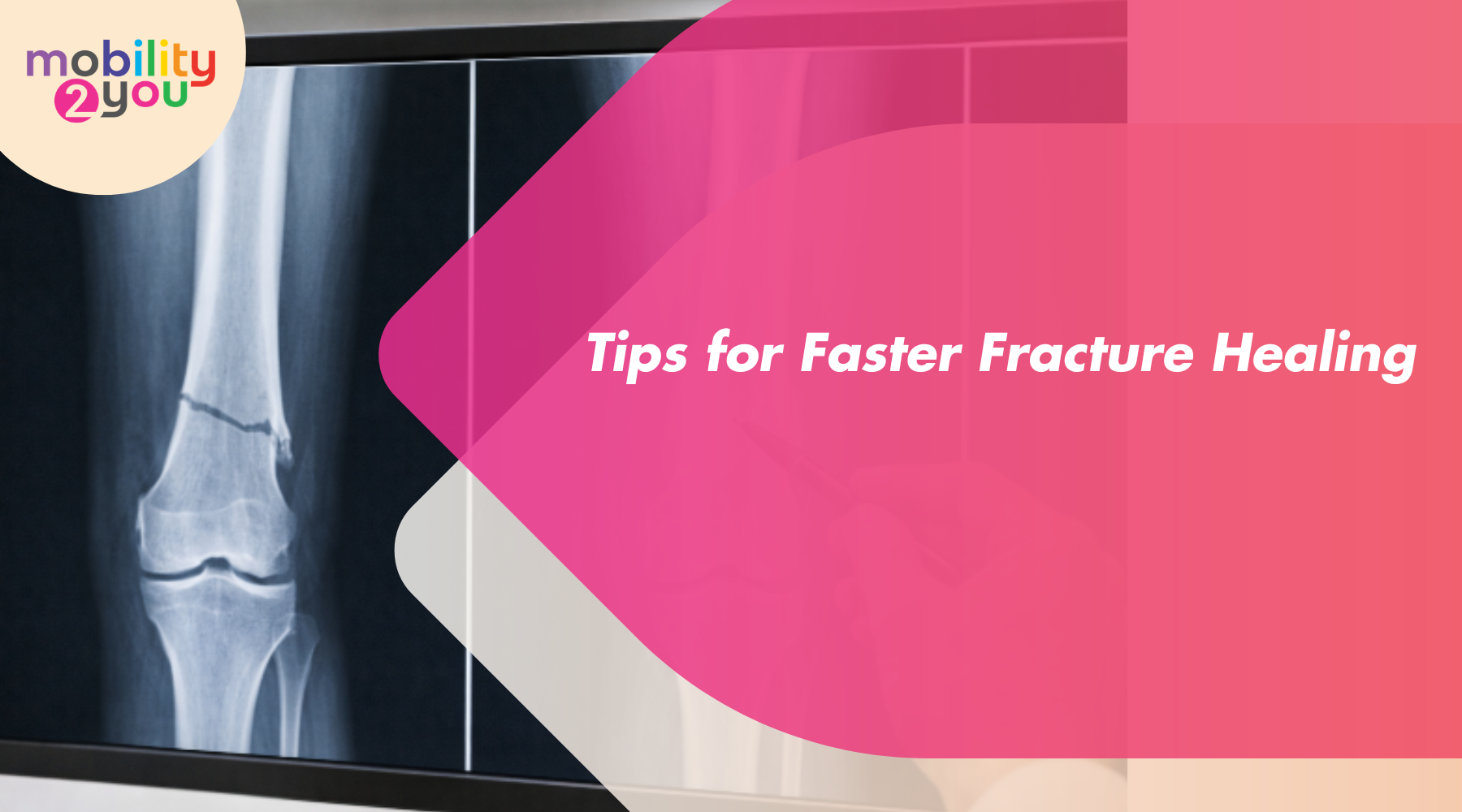 Tips for Faster Fracture Healing