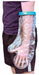 Waterproof Cast and Bandage Protectoar for use whilst Showering/Bathing (Adult-Short Arm) from Aidapt - Mobility 2 You.